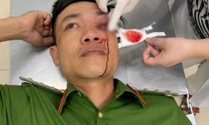 Bình Thuận: Đại úy E2 bet đá gà trực tiếp bị thương khi truy bắt đối tượng Thể Thao E2BET VIP trong đêm