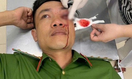 Bình Thuận: Đại úy E2 bet đá gà trực tiếp bị thương khi truy bắt đối tượng Thể Thao E2BET VIP trong đêm
